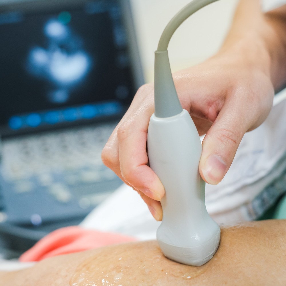 Ecocardiograma Fetal E Pediátrico