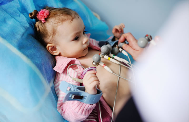 Eletrocardiograma